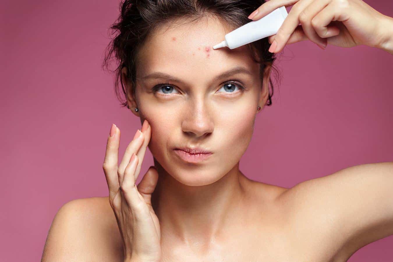 How To Reduce Pimples On Dry Skin
