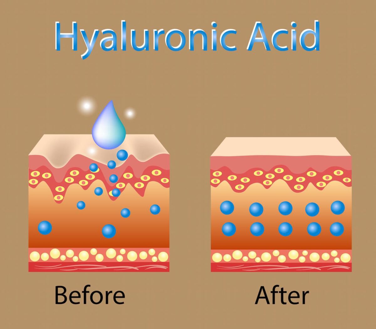 What Does Hyaluronic Acid Do For Acne? | Viviane Woodard Skincare