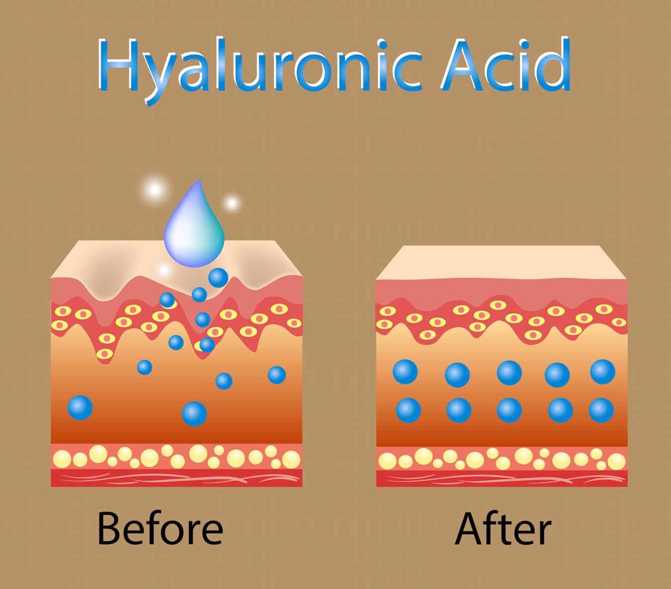 Hyaluronic acid helps with skin cell turnover and is a hydrating skincare ingredient